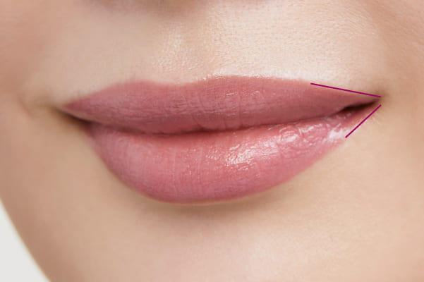 【LIPS】ローズリップ＋後のせリップライナー
