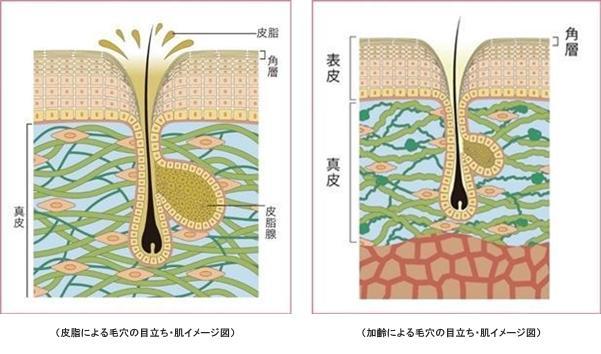 毛穴が目立ってしまう2大原因と肌の状態とは？