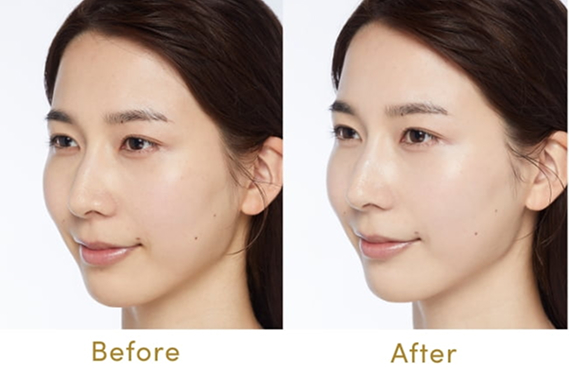 ライトピンクパール