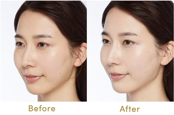 before / after