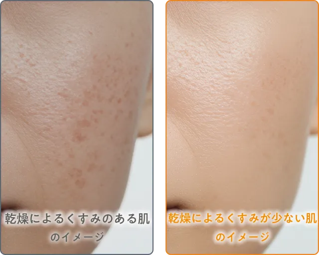 乾燥によるくすみのビフォーアフター比較