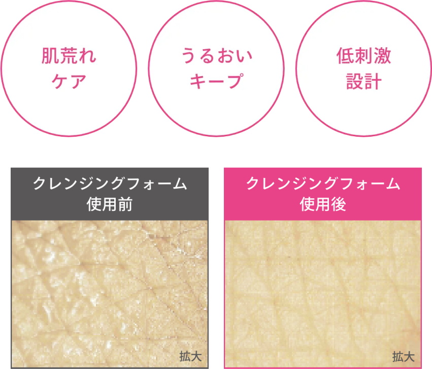 肌荒れケア／うるおいキープ／低刺激設計