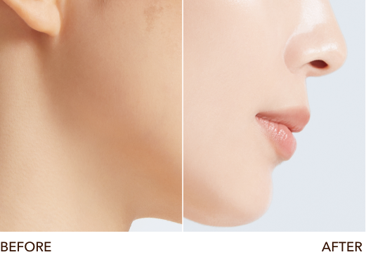 Before・After