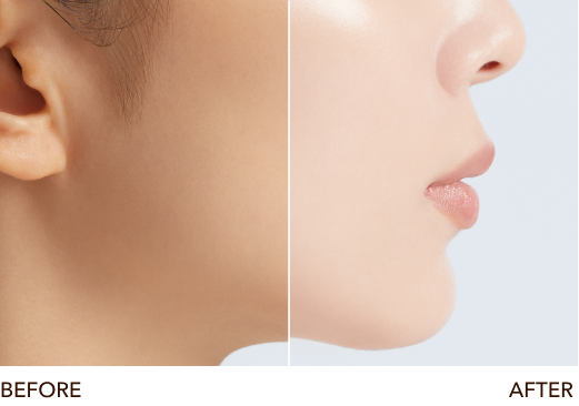 Before・After
