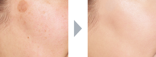 使用前・使用後