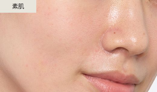 素肌