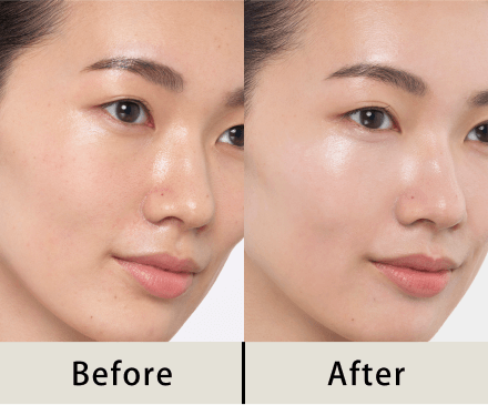 商品画像 Before After