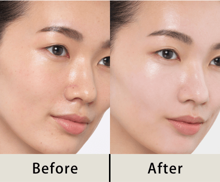 商品画像 Before After