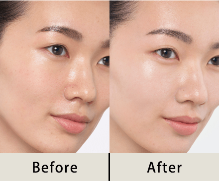 商品画像 Before After