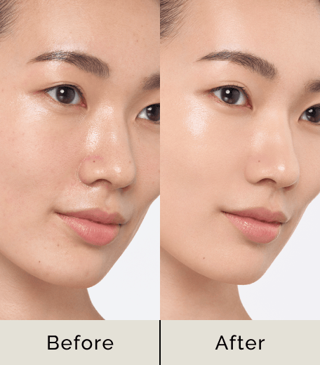 Before After