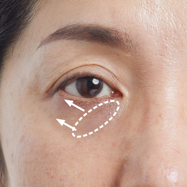 目の周りのクマのメイン画像