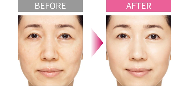 BEFORE AFTER