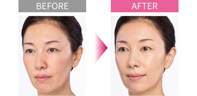 BEFORE AFTER