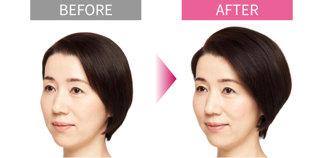 ヘアケアアイテム 仕上がりイメージ