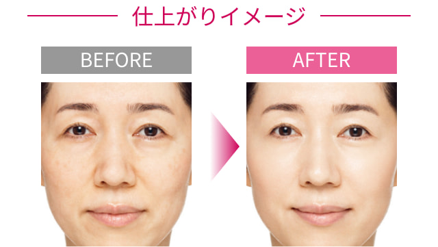 仕上がりイメージ